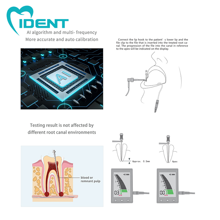 Dental Laboratory MINI Micropex Surgical Root Canal Apex Locator Root Canal Measurement Portable Machine Dentistry Tool - Image 3