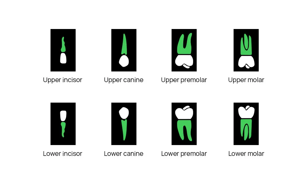Dental x-ray machine - Image 11
