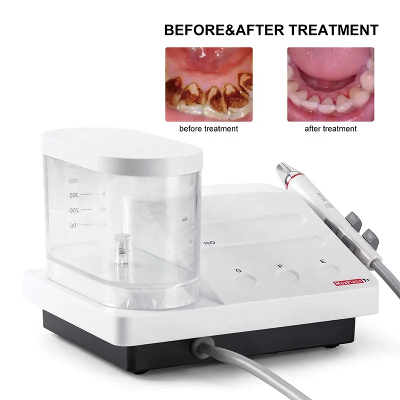 Dental Portable LED Detachable Handpiece Dental Ultrasonic Scaler woodpecker - Image 4