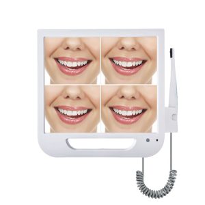 Dental Intra Oral Camera