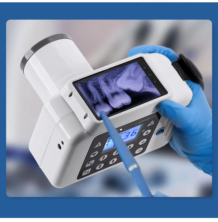 Dental Digital dental X-ray machine Dental X-ray sensor, Portable dental X-ray, Dental radiography equipment  With image display function - Image 5