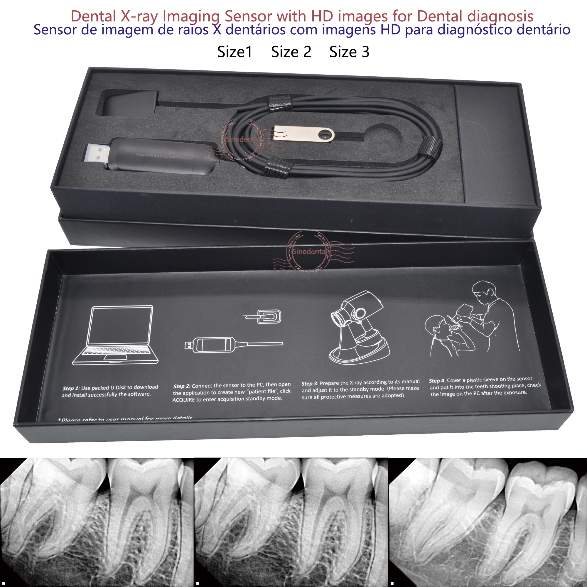 Hot Sale RVG Dental Sensor with Holder Faster/Recycle/Durable USB Dental X Ray Sensor IntraOral Camera Digital RVG Sensor - Image 2