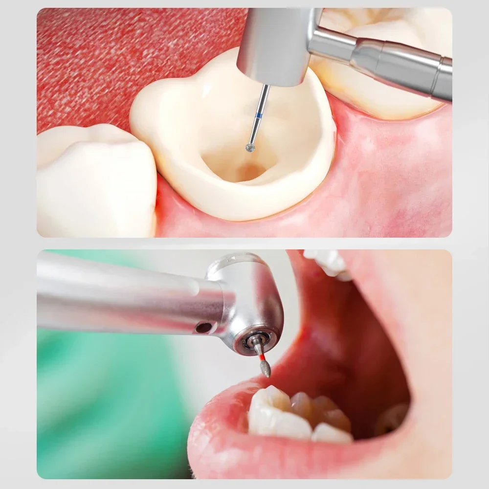 Dental diamond bur, Diamond dental bur, Dental diamond drill, Diamond bur dental - Image 6