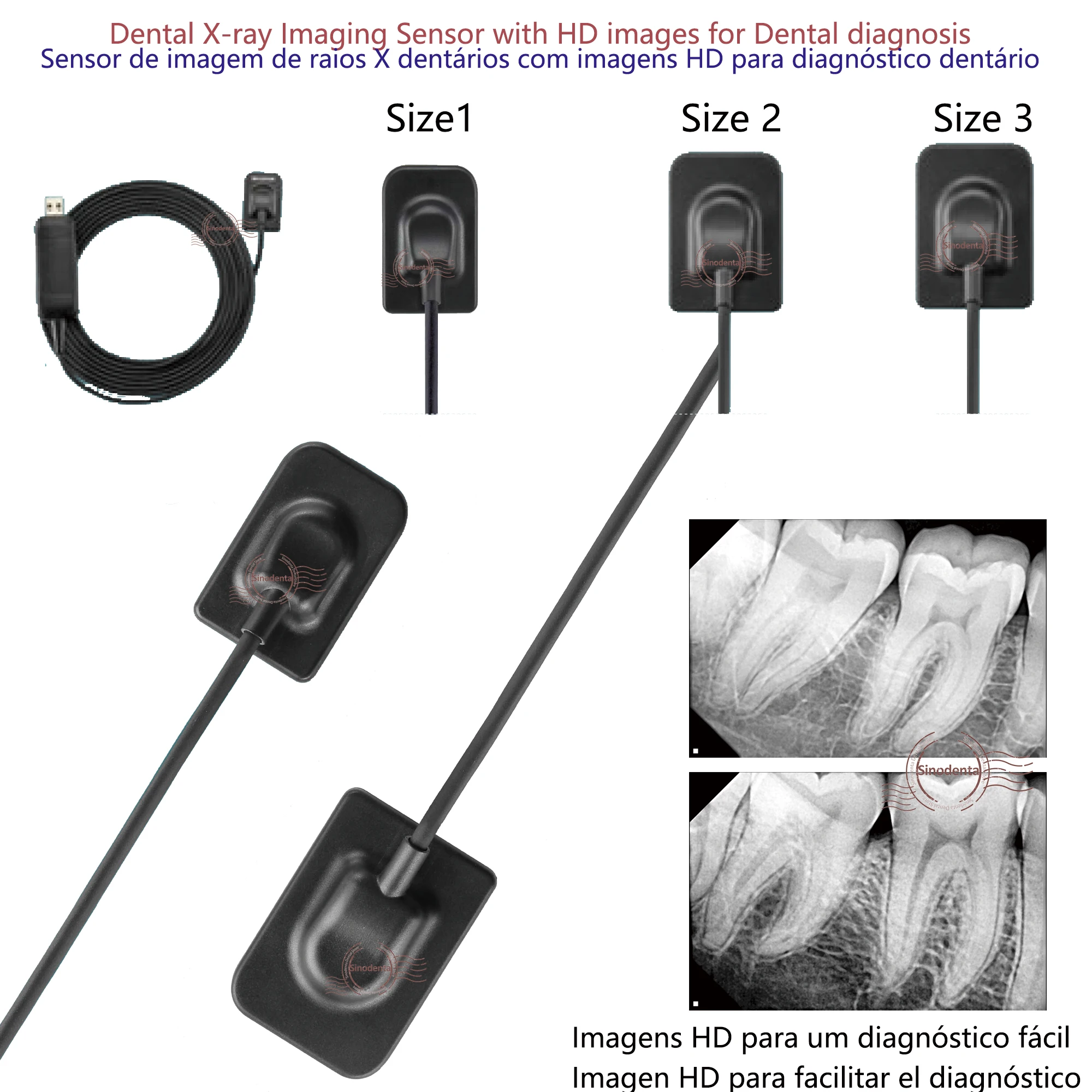 Hot Sale RVG Dental Sensor with Holder Faster/Recycle/Durable USB Dental X Ray Sensor IntraOral Camera Digital RVG Sensor